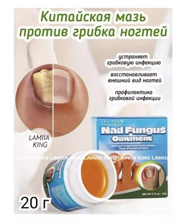 Cosmetics Chinese remedy for nail fungus 20 g