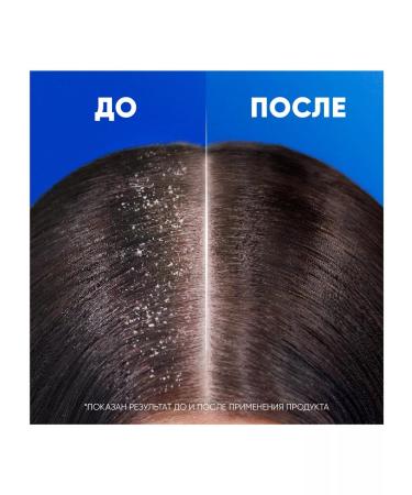 Head & Shoulders Hair loss shampoo 400ml - Buy Online on GoSupps.com