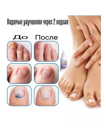 Sumifun Nail Care Liquid Wellness cosmetics