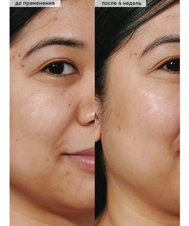 Glow Recipe Watermelon Glow Niacinamide Drops Facial Waste - Buy Online on GoSupps.com