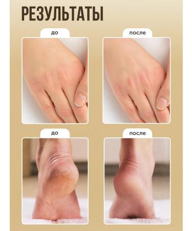 biothal Cream wax from cracks and peeling for dry skin set 2 pcs - Buy Online on GoSupps.com