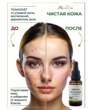 MoiDivi Tea tree oil for nails and cuticles 30 ml - Buy Online on GoSupps.com