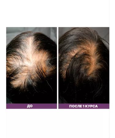 Phyto serum against hair loss for women 12x5 ml - Buy Online on GoSupps.com