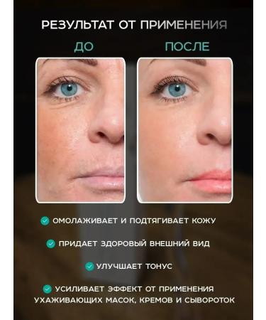 SKIN BEAUTY Mesoroller for the face of hair and body from wrinkles dermaroller 0.3mm - Buy Online on GoSupps.com