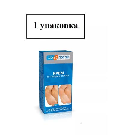 Before and After Cream from cracks in the feet 50ml-1u