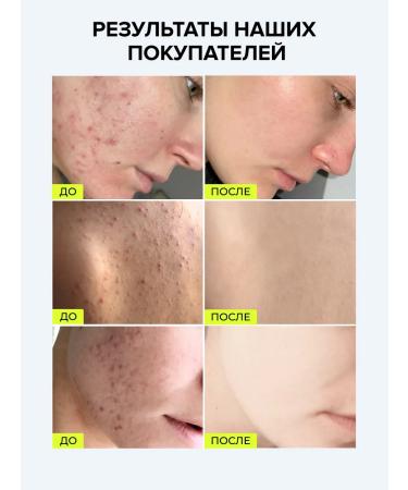 CARBON THEORY Facial soap with salicylic acid from black dots - Buy Online on GoSupps.com