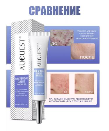 Acne and acne serum - Buy Online on GoSupps.com