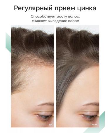 SmartLife Liquid zinc ionized for men and women 3pcs - Buy Online on GoSupps.com