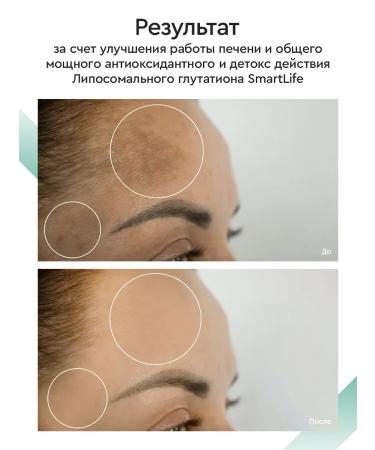 SmartLife Glutation Liposomal 100 ml for beauty and youth 2 pcs - Buy Online on GoSupps.com