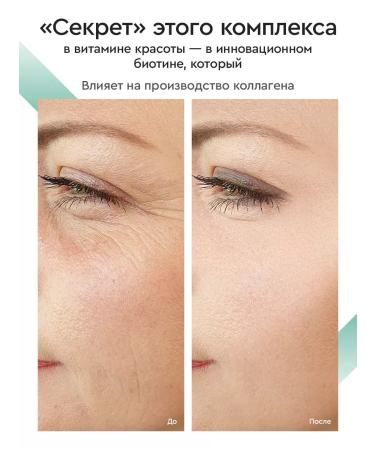 SmartLife Vitamins for hair skin and nails 2pcs - Buy Online on GoSupps.com