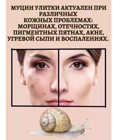 CoSmoVawesaz Rejuvenating whey with mucin snail - Buy Online on GoSupps.com