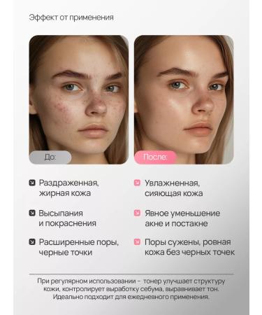 Geodemics Hyaluronic tonic with acidic acids cleansing 200 ml - Buy Online on GoSupps.com