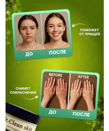 Dr Medical cream for dermatitis eczema psoriasis acne - Buy Online on GoSupps.com