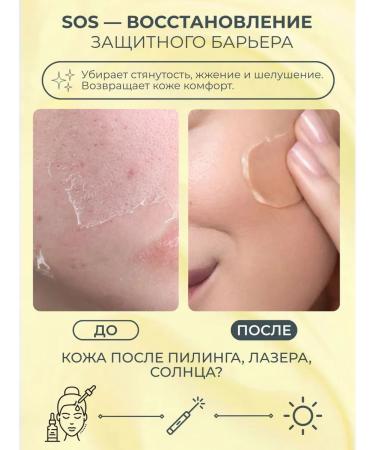 Atopalm Moil face cream Lamellar Mle Cream - Buy Online on GoSupps.com