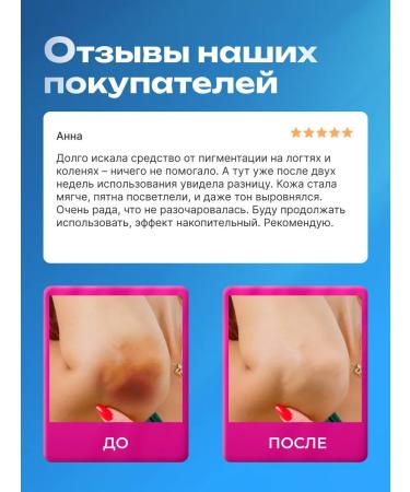 lvcos Whitening cream for the face and body serum - Buy Online on GoSupps.com