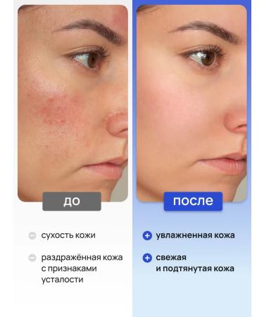 DEONICA Facial tonic 5 in 1 moisturizing and cleansing 200 ml - Buy Online on GoSupps.com