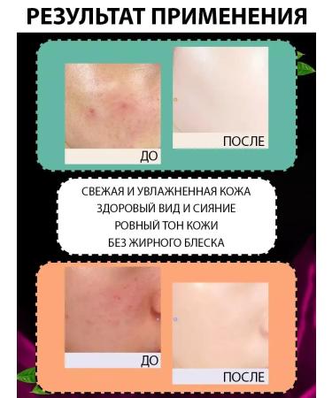 Lolocandy Facial corrector - Buy Online on GoSupps.com