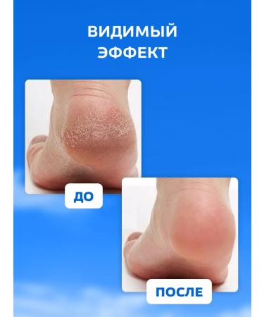 Floresan Toe cream with urea - Buy Online on GoSupps.com