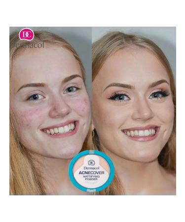 Dermacol Acnecover problem skin powder (Honey) - Buy Online on GoSupps.com