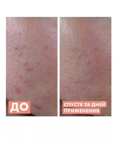 AVENE Cleanance aha Updating serum for problem skin 30ml - Buy Online on GoSupps.com