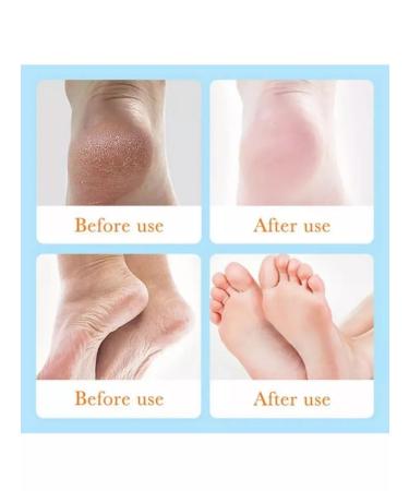 sadoer Hel-pencil for the legs - Buy Online on GoSupps.com