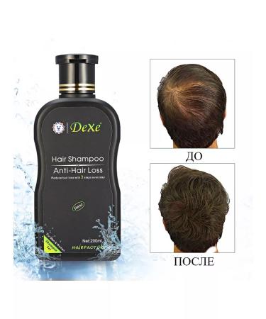 Dexe Shampoo paint from falling out - Buy Online on GoSupps.com