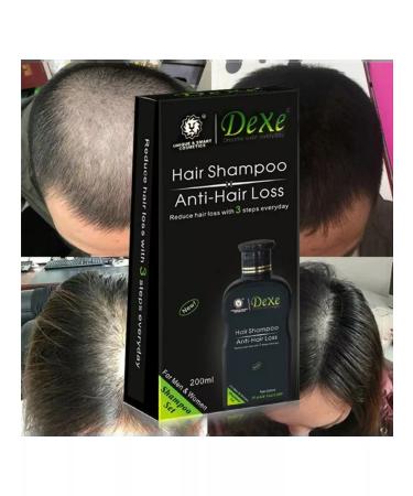 Dexe Shampoo paint from falling out - Buy Online on GoSupps.com