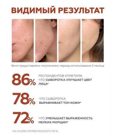 Geltek Facial serum with retinol - Buy Online on GoSupps.com