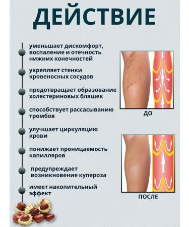 SIBERIA-SHOP Ointment from varicose veins on the legs against severity and edema - Buy Online on GoSupps.com