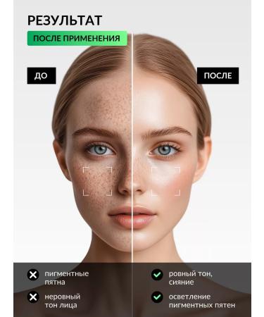 Beaute Attendue Turkish serum sulfur from dark spots and pigmentation - Buy Online on GoSupps.com