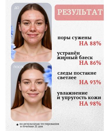 MOIKA Facial serum with niacinamide - Buy Online on GoSupps.com