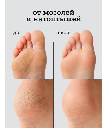 Quinselia Cream-Vosk from cracks for very dry skin with urea 20% - Buy Online on GoSupps.com