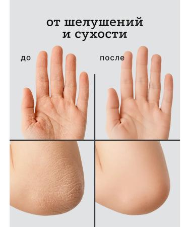 Quinselia Cream-Vosk from cracks for very dry skin with urea 20% - Buy Online on GoSupps.com