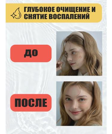 EDEN Acne Facial Set: 3 Products - Buy Online on GoSupps.com