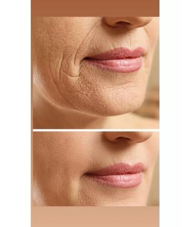 EcoBeauty NL Peptide powder collag with the taste of cherry with vitamin C - Buy Online on GoSupps.com