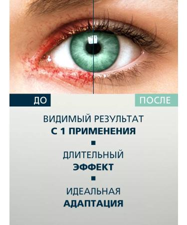 Epideril Gel for problem skin around the eyes 100ml - Buy Online on GoSupps.com