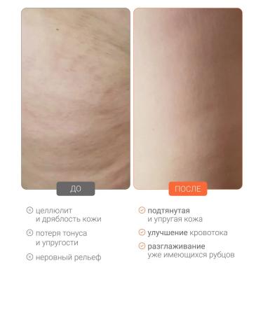 DLYa da KOJi Serum concentrate for body anti -cellulite mini - Buy Online on GoSupps.com