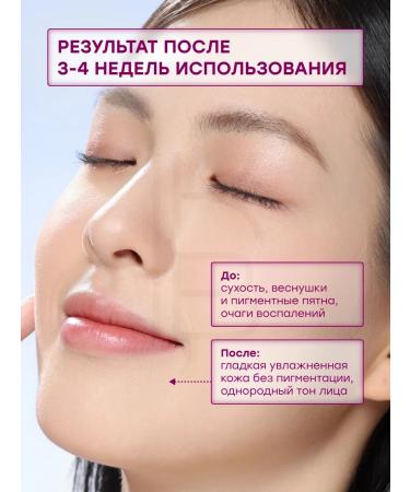 NINELESS Facial serum with niacinamide - Buy Online on GoSupps.com