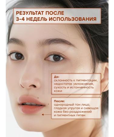 NINELESS Facial serum with transxamic acid - Buy Online on GoSupps.com