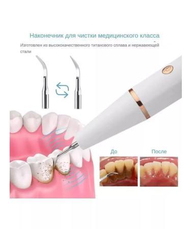 Philips Skaren ultrasound - Buy Online on GoSupps.com