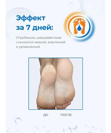 AQUAPEELING Cream from corns and corns - Buy Online on GoSupps.com