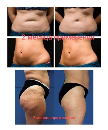 SunMy A set of wraps is anti -cellulite - Buy Online on GoSupps.com