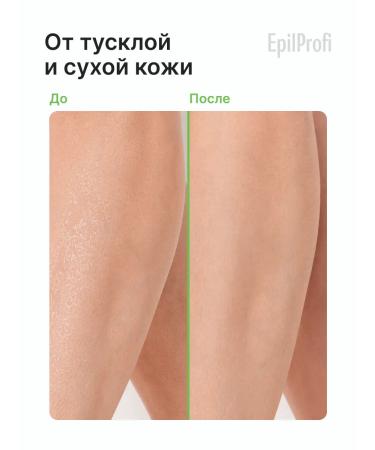 EpilProfi A set of hand and body creams maximum moisture - Buy Online on GoSupps.com