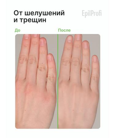 EpilProfi A set of hand and body creams maximum moisture - Buy Online on GoSupps.com