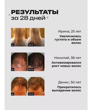 lvcos Hair growth serum 5 1 - Buy Online on GoSupps.com