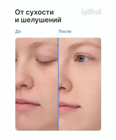 EpilProfi Facial set. Day cream + night cream for face - Buy Online on GoSupps.com