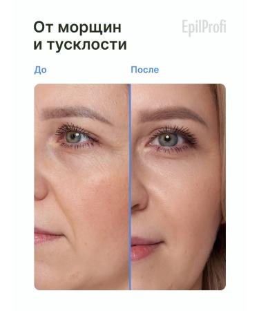 EpilProfi Facial set. Day cream + night cream for face - Buy Online on GoSupps.com