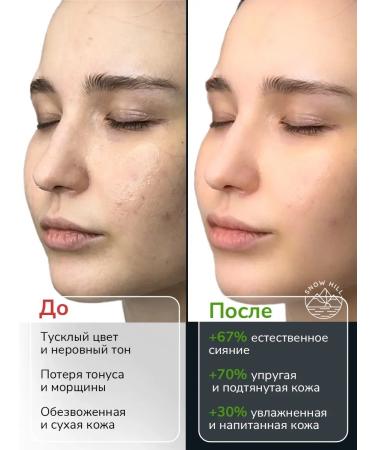 Snow Hill Facial mask fabric from algae 10 pieces - Buy Online on GoSupps.com