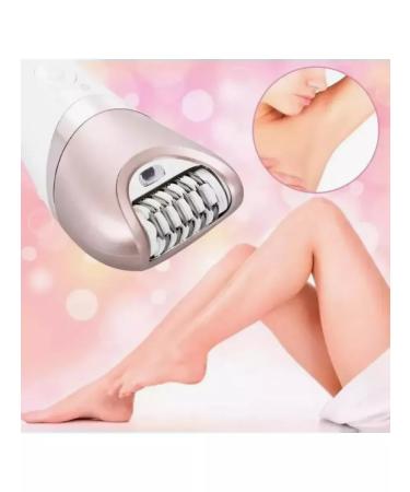 MI Epalator female departer ElectroePalator