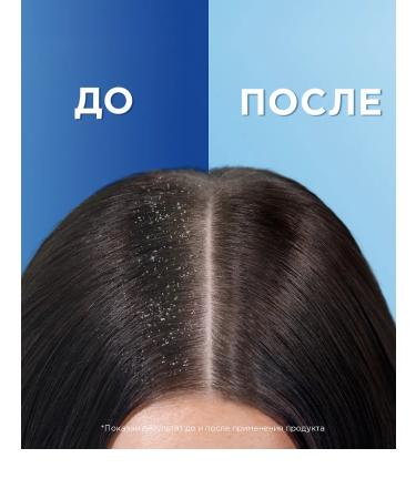 Head&Shoulders HEAD & ShULDERS hair shampoo with coconut 400 ml - Buy Online on GoSupps.com